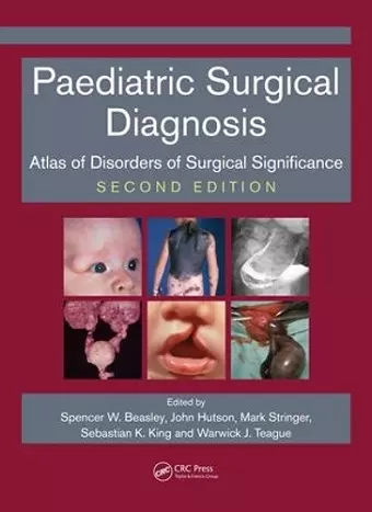 Paediatric Surgical Diagnosis cover