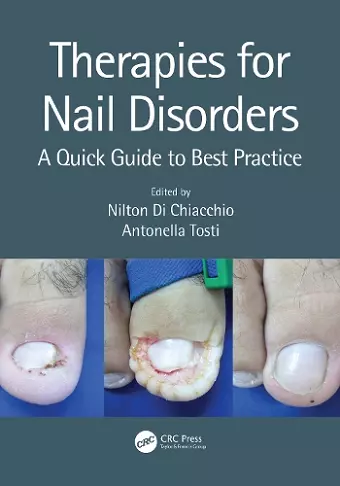 Therapies for Nail Disorders cover