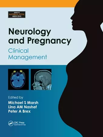 Neurology and Pregnancy cover