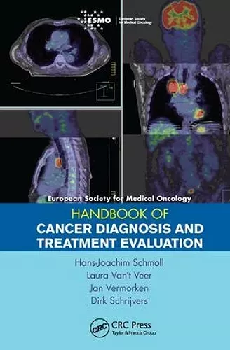 ESMO Handbook of Cancer Diagnosis and Treatment Evaluation cover