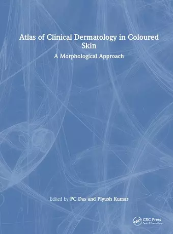 Atlas of Clinical Dermatology in Coloured Skin cover