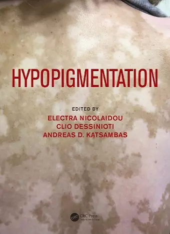 Hypopigmentation cover