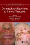 Dermatologic Reactions to Cancer Therapies cover