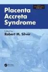 Placenta Accreta Syndrome cover