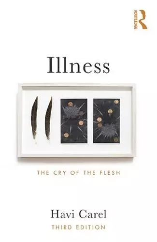 Illness cover