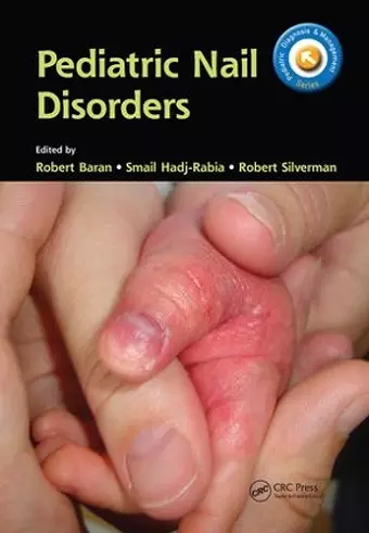 Pediatric Nail Disorders cover