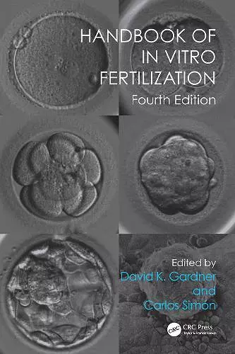 Handbook of In Vitro Fertilization cover