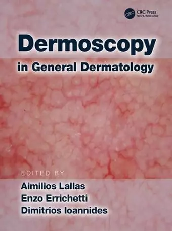 Dermoscopy in General Dermatology cover