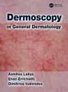 Dermoscopy in General Dermatology cover