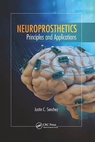 Neuroprosthetics cover