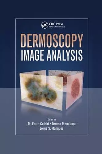 Dermoscopy Image Analysis cover