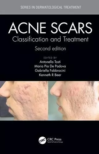 Acne Scars cover