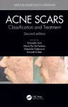 Acne Scars cover