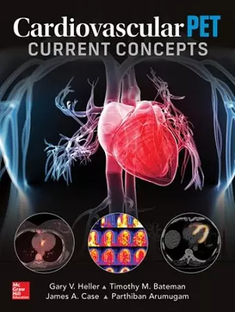 Cardiovascular PET: Current Concepts cover