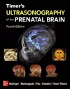 Timor's Ultrasonography of the Prenatal Brain, Fourth Edition cover