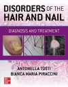 Disorders of the Hair and Nail: Diagnosis and Treatment cover