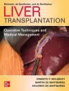 Liver Transplantation: Operative Techniques and Medical Management cover