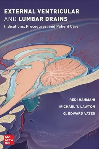 External Ventricular and Lumbar Drains: Indications, Procedures, and Patient Care cover