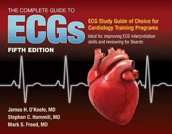 The Complete Guide to ECGs: a Comprehensive Study Guide to Improve ECG Interpretation Skills cover
