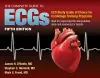 The Complete Guide to ECGs: a Comprehensive Study Guide to Improve ECG Interpretation Skills cover