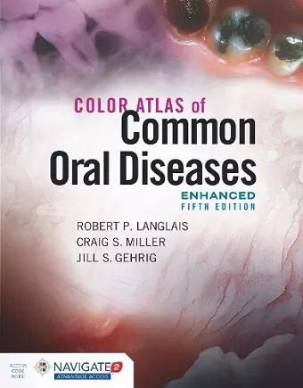 Color Atlas of Common Oral Diseases, Enhanced Edition cover
