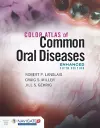 Color Atlas of Common Oral Diseases, Enhanced Edition cover