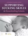 Supporting Sucking Skills in Breastfeeding Infants cover