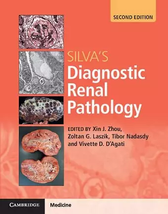 Silva's Diagnostic Renal Pathology cover