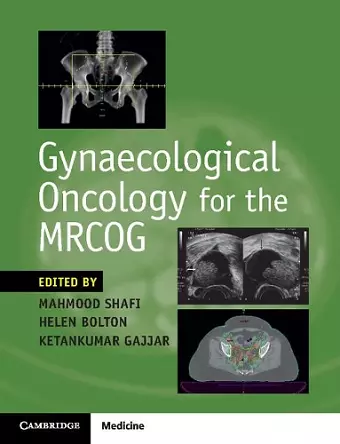 Gynaecological Oncology for the MRCOG cover