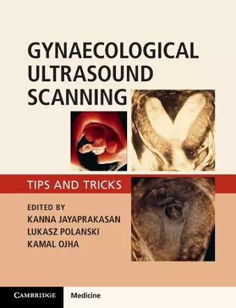 Gynaecological Ultrasound Scanning cover