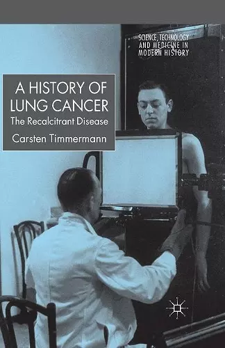 A History of Lung Cancer cover