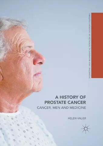 A History of Prostate Cancer cover