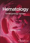 Hematology cover