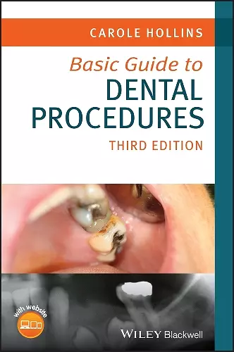 Basic Guide to Dental Procedures cover