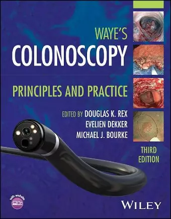 Colonoscopy cover