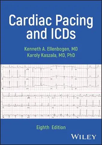 Cardiac Pacing and ICDs cover
