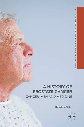 A History of Prostate Cancer cover
