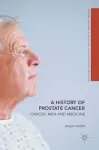 A History of Prostate Cancer cover