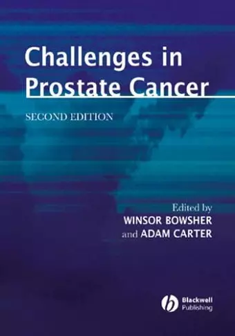 Challenges in Prostate Cancer cover