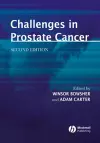 Challenges in Prostate Cancer cover