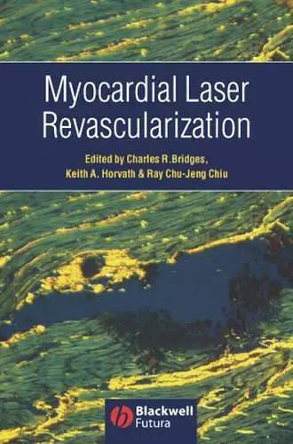 Myocardial Laser Revascularization cover