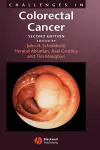 Challenges in Colorectal Cancer cover