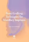 Bone Grafting Techniques for Maxillary Implants cover