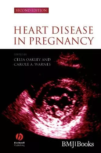 Heart Disease in Pregnancy cover