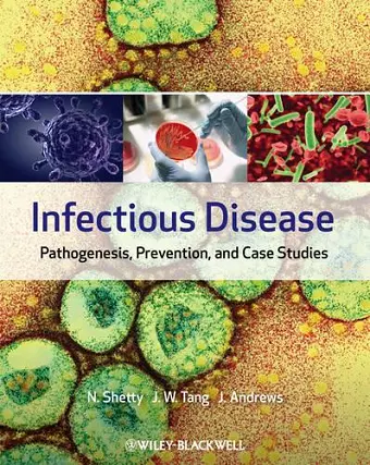 Infectious Disease cover