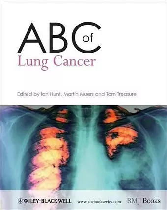 ABC of Lung Cancer cover