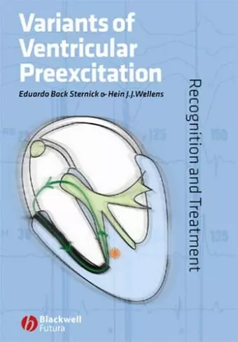 Variants of Ventricular Preexcitation cover