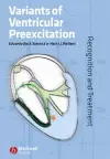 Variants of Ventricular Preexcitation cover