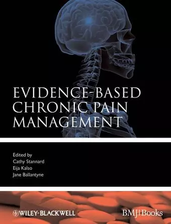 Evidence-Based Chronic Pain Management cover