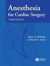 Anesthesia for Cardiac Surgery cover